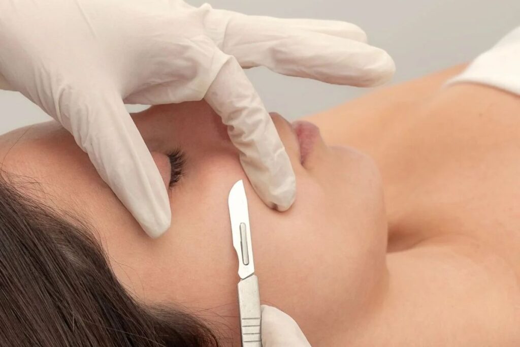 Peach Fuzz Removal With Dermaplaning at Glow Up Studio