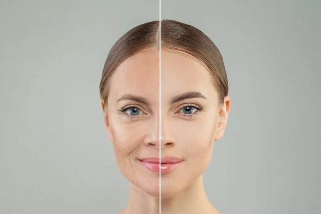 Anti Aging Facials at Glow Up Studio Dallas 2026