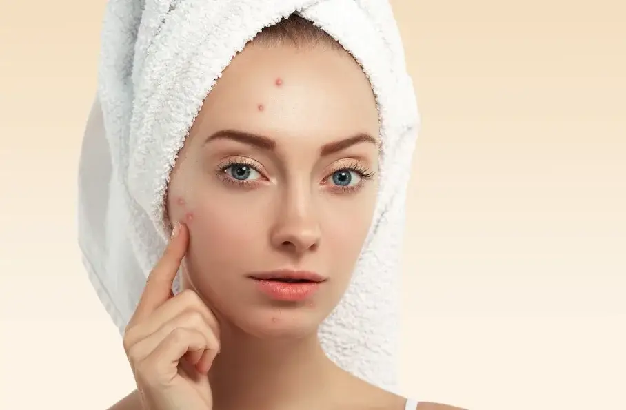 Woman pointing to breakouts on her cheek caused by dallas weather skin stress like humidity and heat